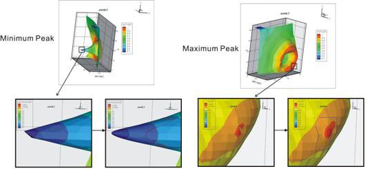 Local peak detection by B-spline interpolation method